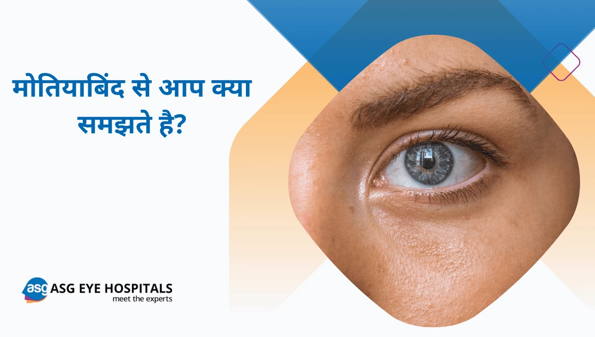 मोतियाबिंद क्या है