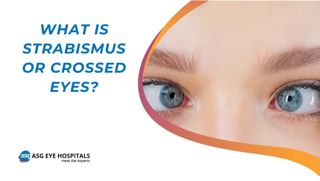 What is strabismus or crossed eyes
