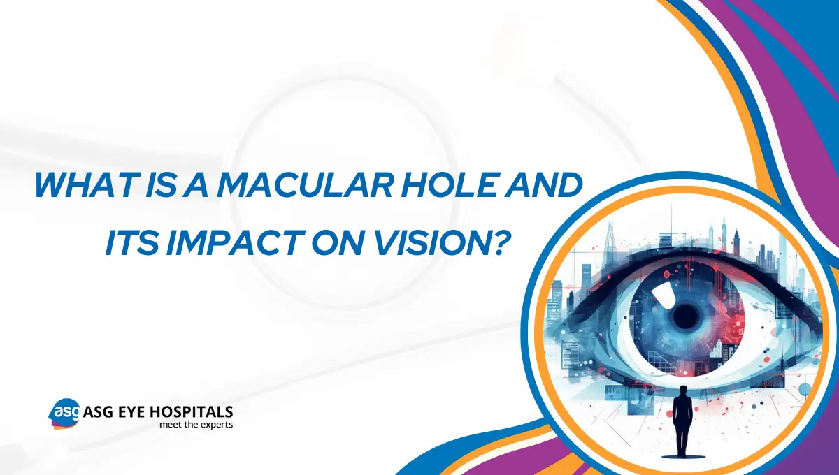 What is a Macular Hole and Its Impact on Vision
