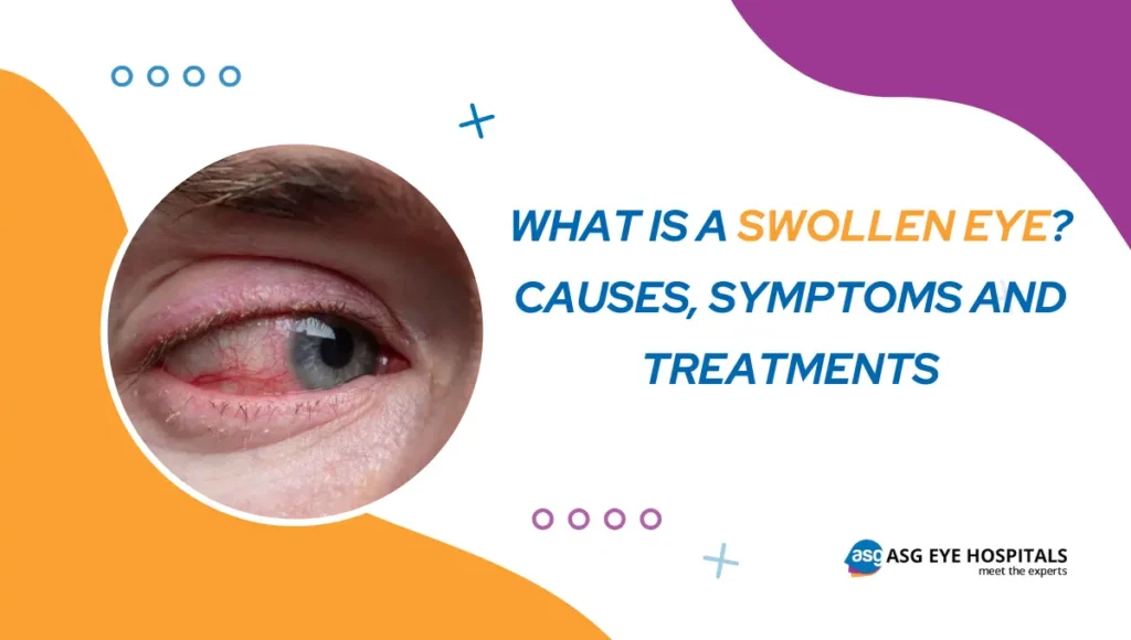 What is the Reasons for Swollen Eyes