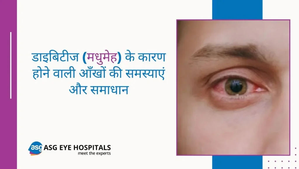 मधुमेह से होने वाली आँखों की समस्याएँ