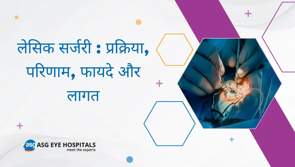 लेसिक सर्जरी प्रक्रिया, परिणाम, फायदे और लागत