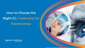 How to Choose the Right ICL Treatment for Keratoconus