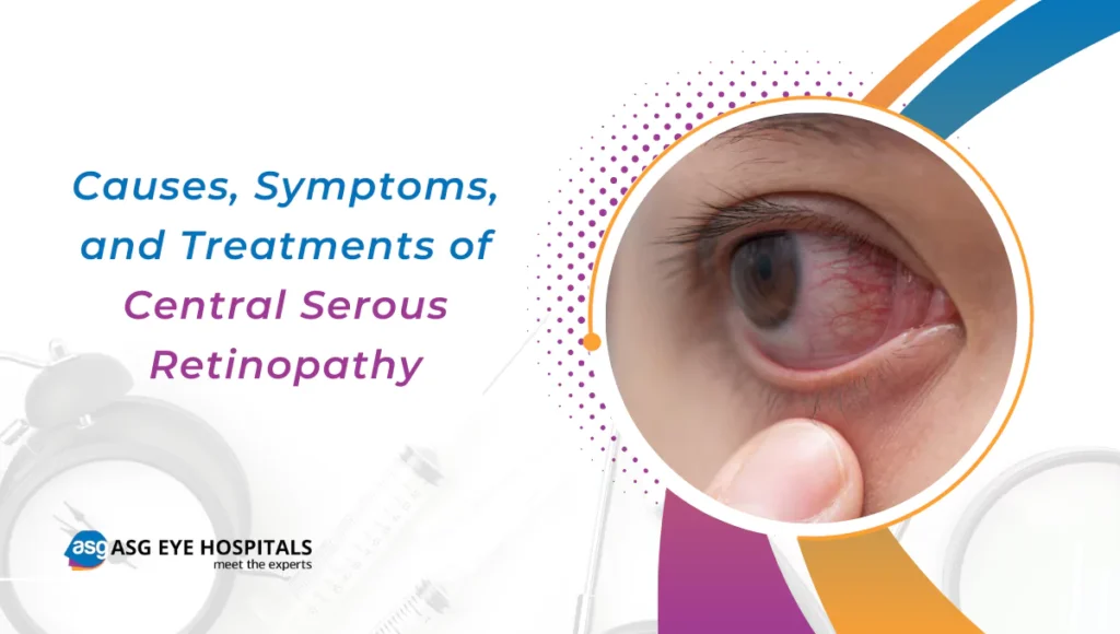 causes-symptoms-and-treatments-of-central-serous-retinopathy