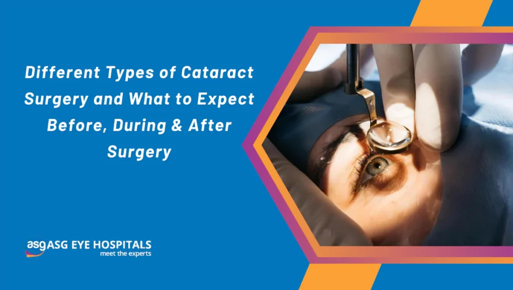 different-types-of-cataract-surgery-