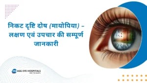 निकट दृष्टि दोष (मायोपिया) – लक्षण एवं उपचार की सम्पूर्ण जानकारी