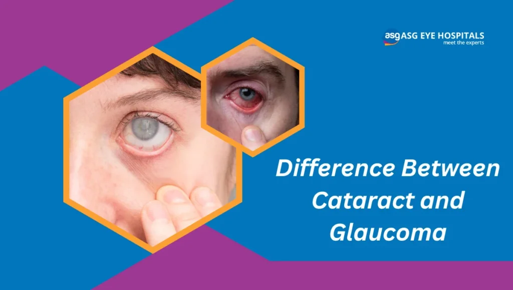Difference Between Cataract and Glaucoma