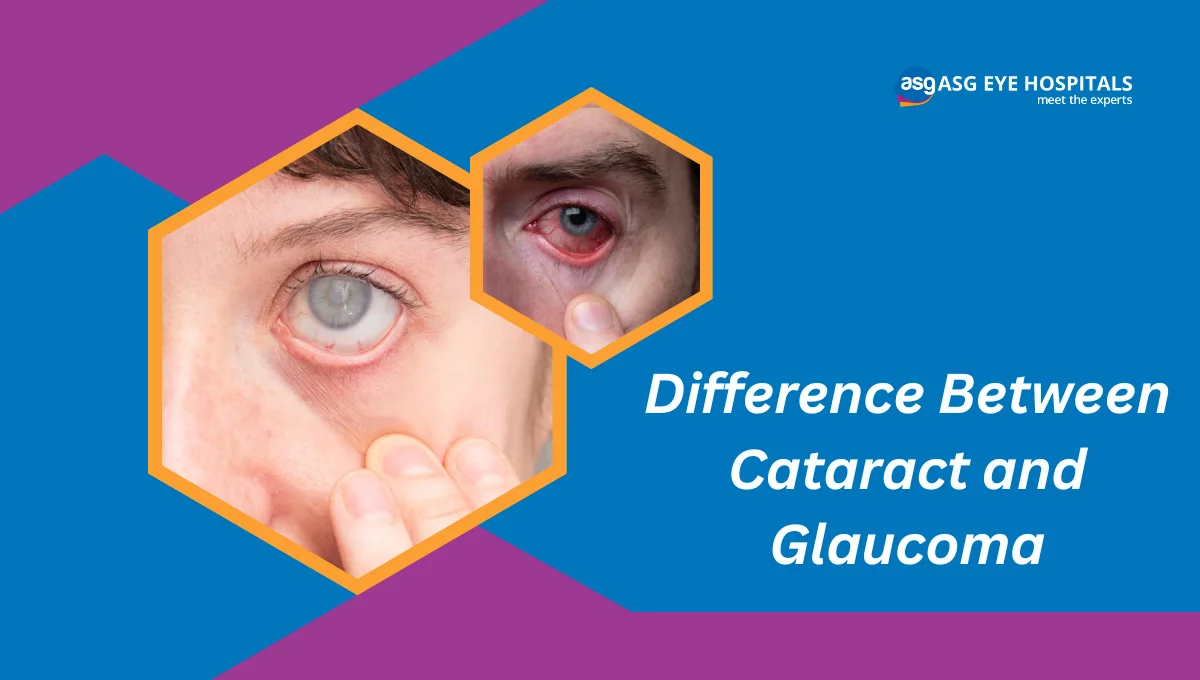 Difference Between Cataract and Glaucoma