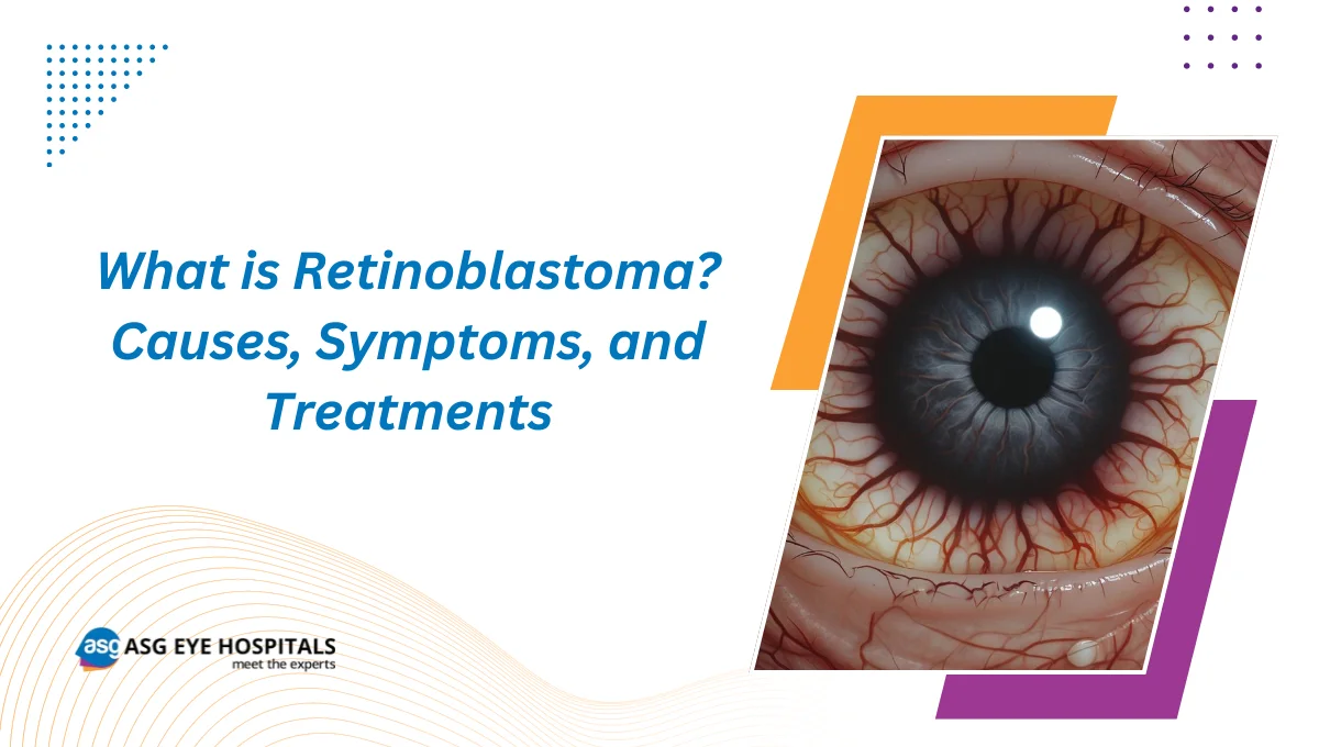 What is Retinoblastoma Causes, Symptoms, and Treatments