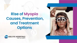 myopia causes