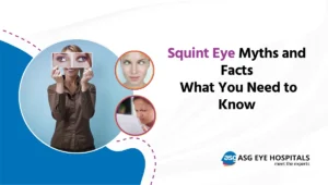Squint Eye Myths and Facts What You Need to Know