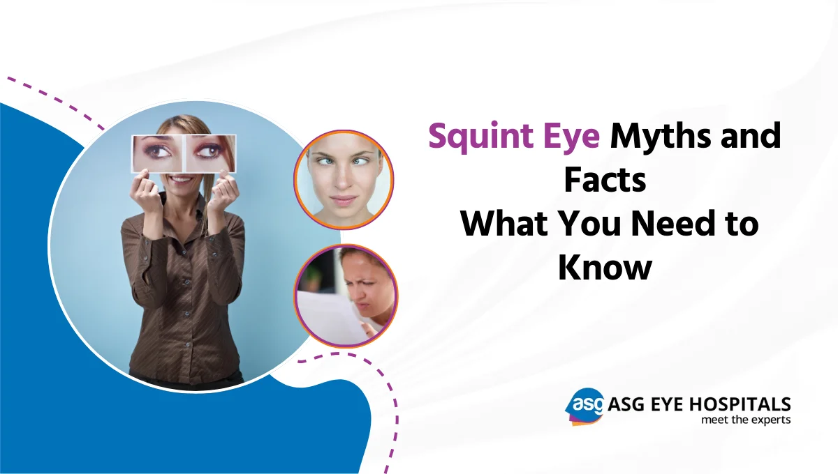 Squint Eye Myths and Facts What You Need to Know