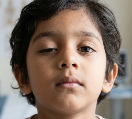 Pediatric Ptosis