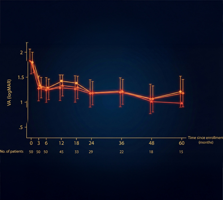 Stable, long-term visual results with predictable outcomes.